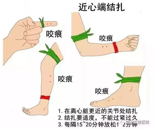 如何快速辨别是否被毒蛇咬伤,识别症状与应对措施 如何快速辨别是否被毒蛇咬伤,识别症状与应对措施